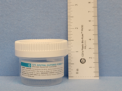 Prefilled 40 ML